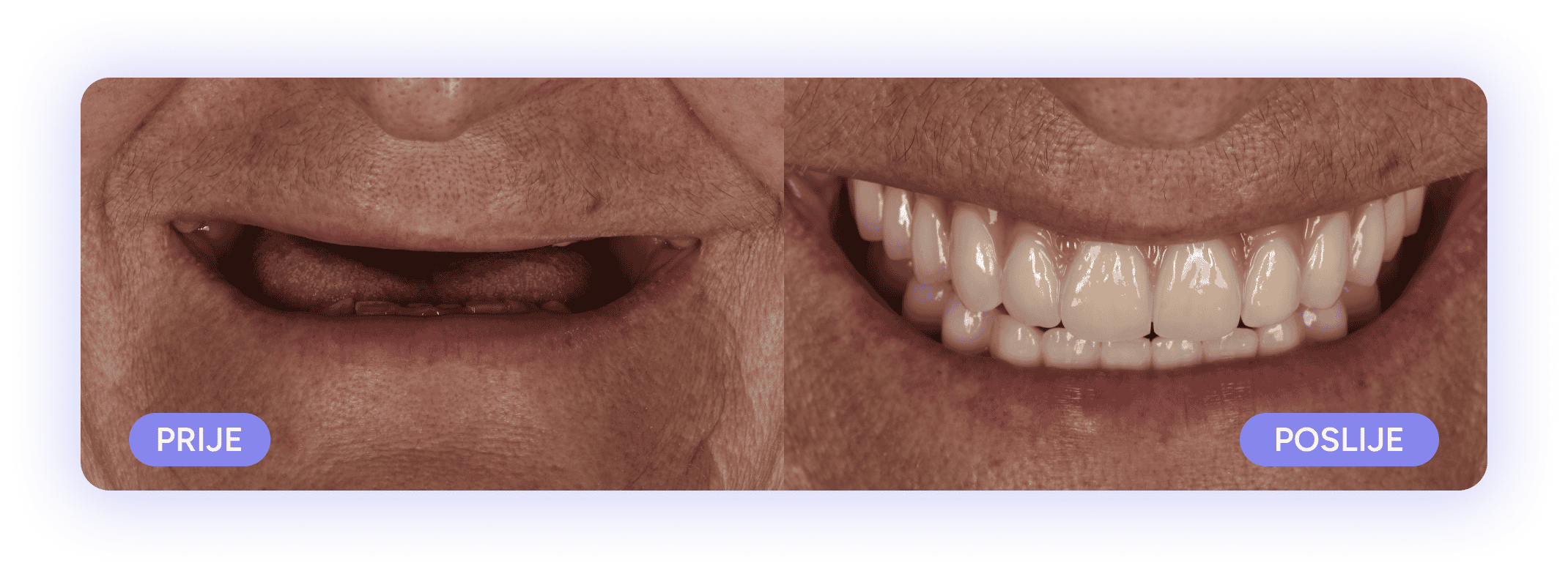 all on 4 slučaj prije i poslije, zagreb, hrvatska